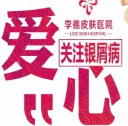 夏季治療銀屑病的5大優(yōu)勢