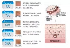 關(guān)于白癜風(fēng)，一般來說有這三個方面的異常表現(xiàn)