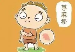 為什么一換季就發(fā)蕁麻疹？該怎么做才好？